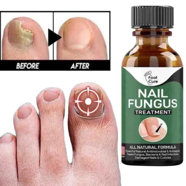 Nail Fungus Treatment serum